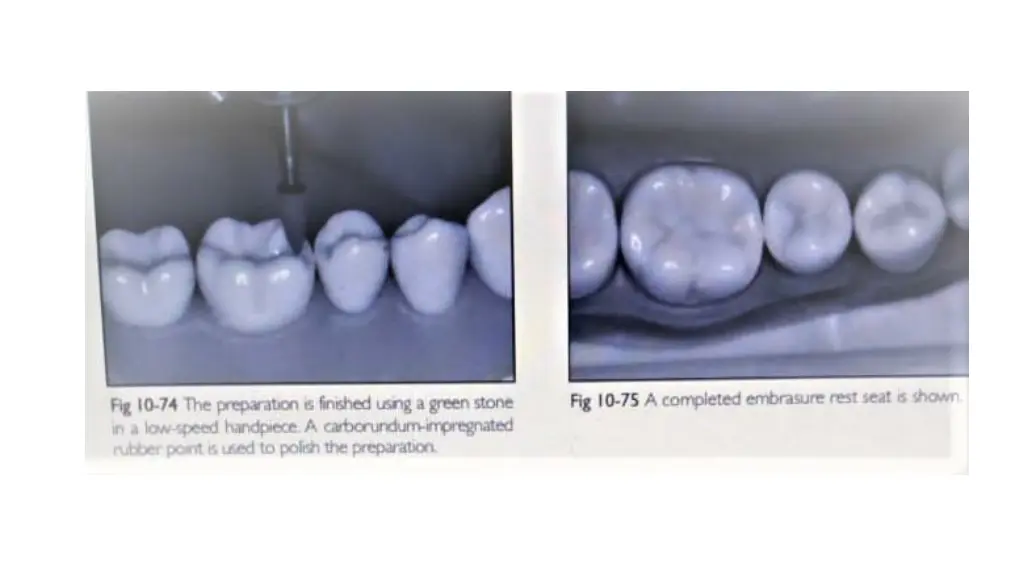 slide16