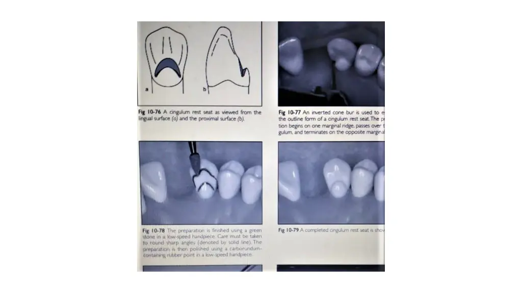slide20