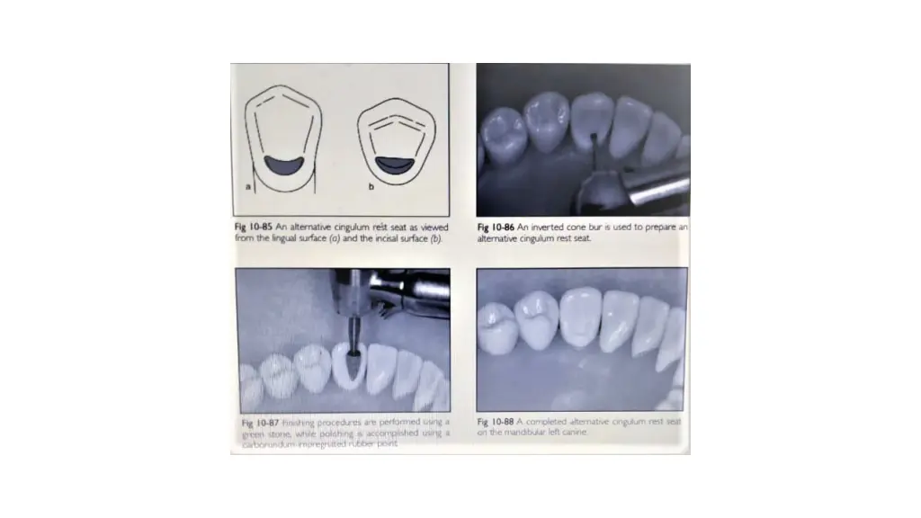 slide24