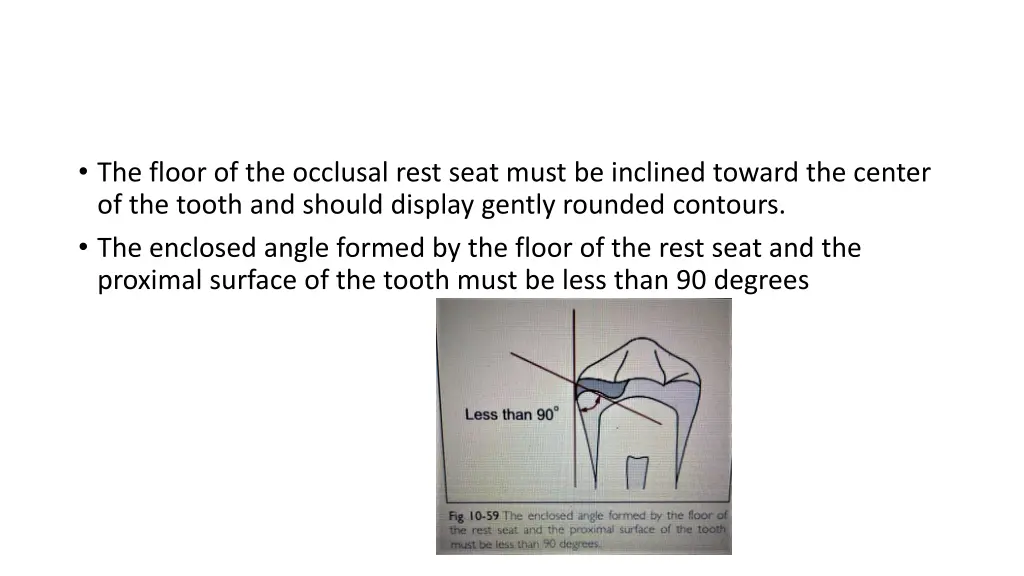 the floor of the occlusal rest seat must