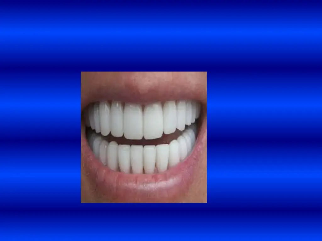 slide31