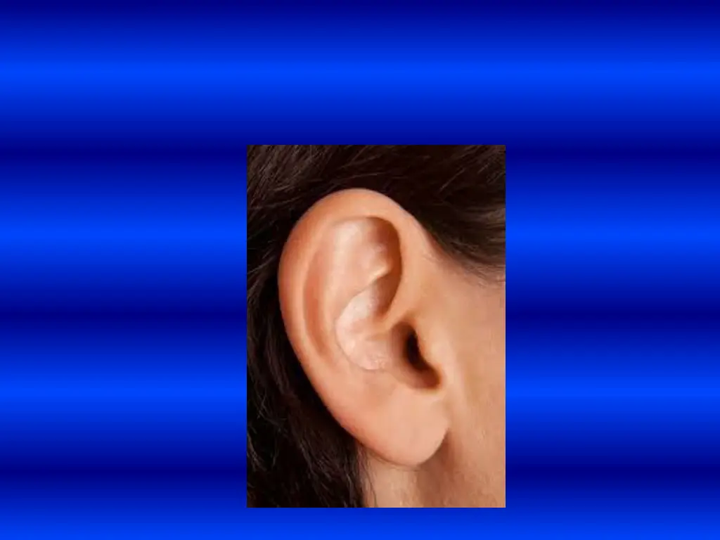 slide32