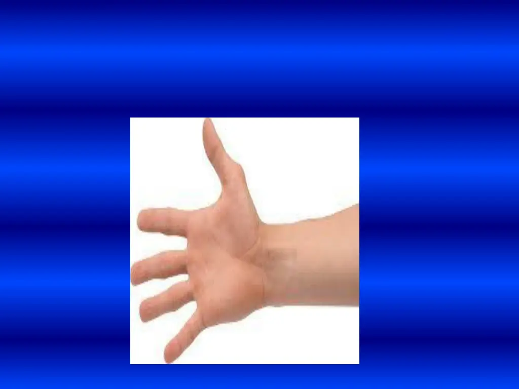 slide33