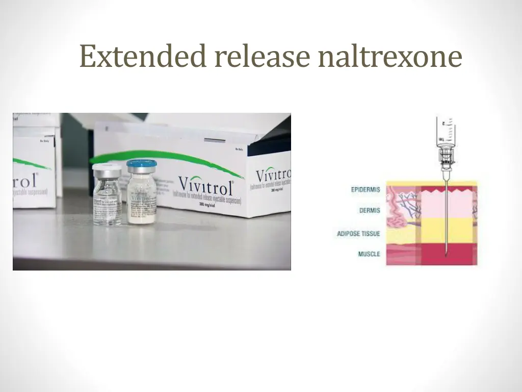 extended release naltrexone