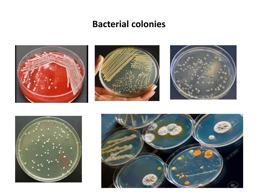 bacterial colonies
