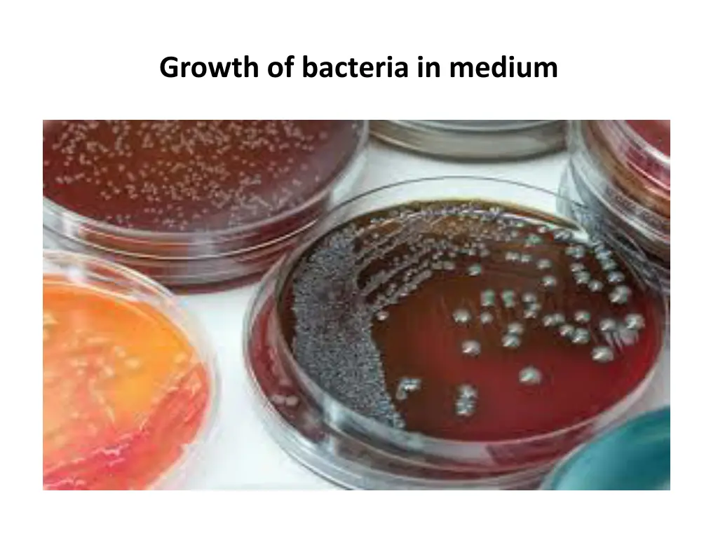 growth of bacteria in medium