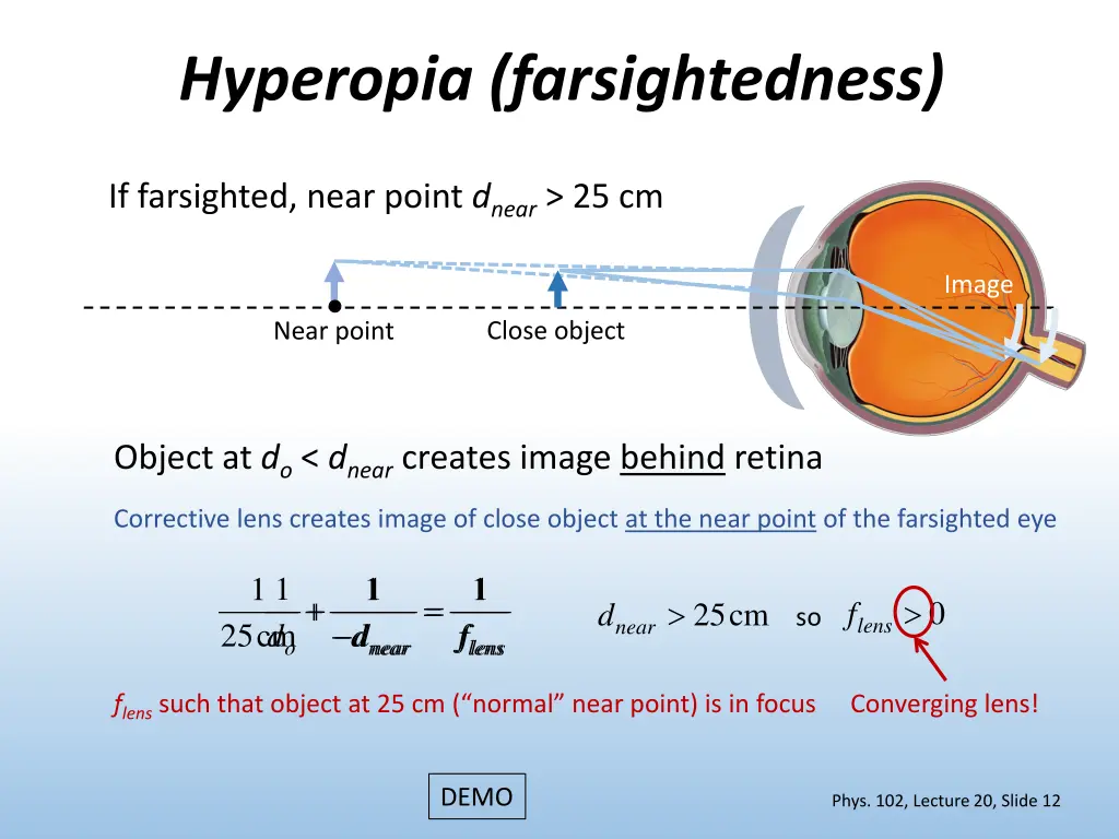hyperopia farsightedness