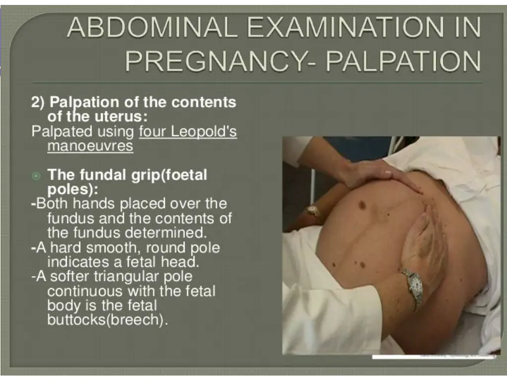 slide11