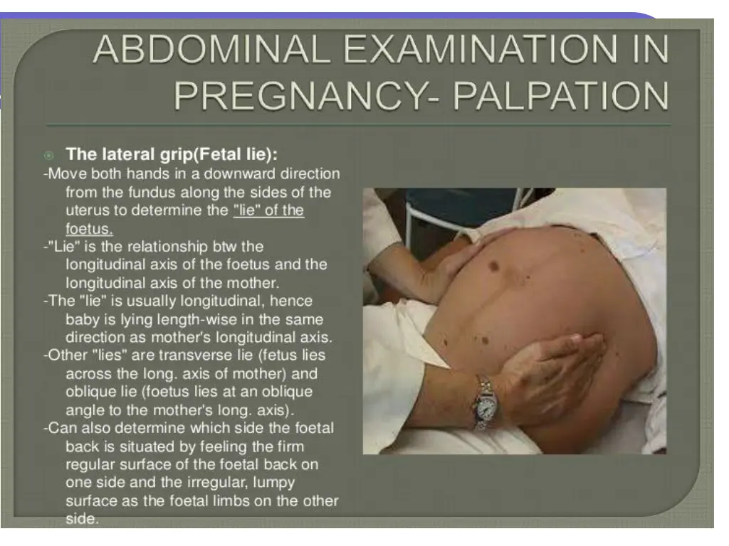 slide12