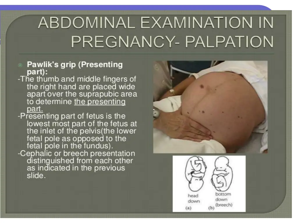 slide13