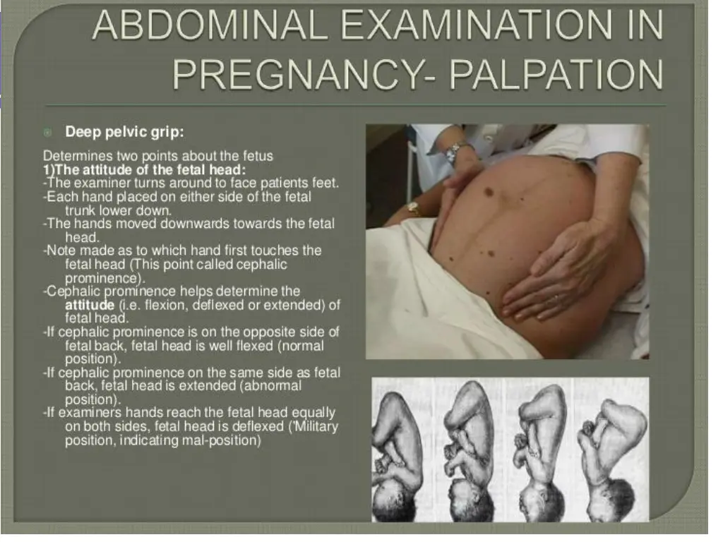 slide14