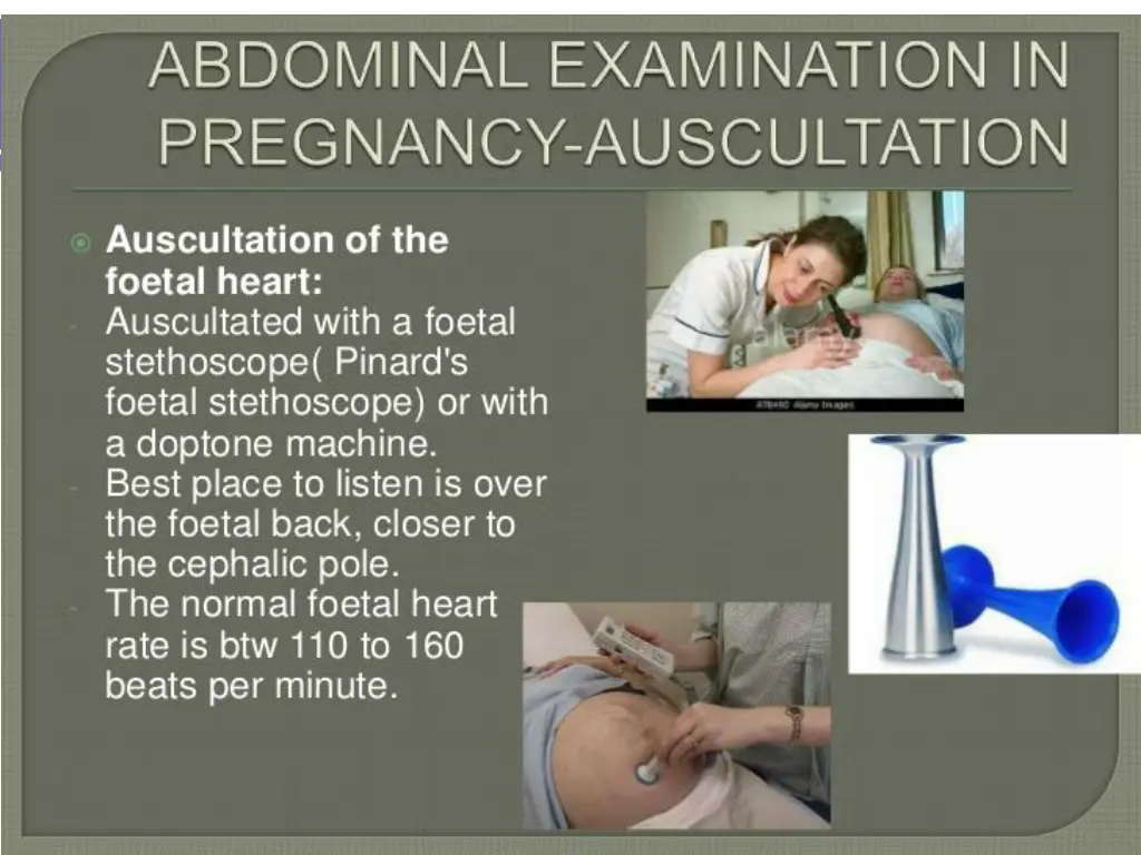 slide16