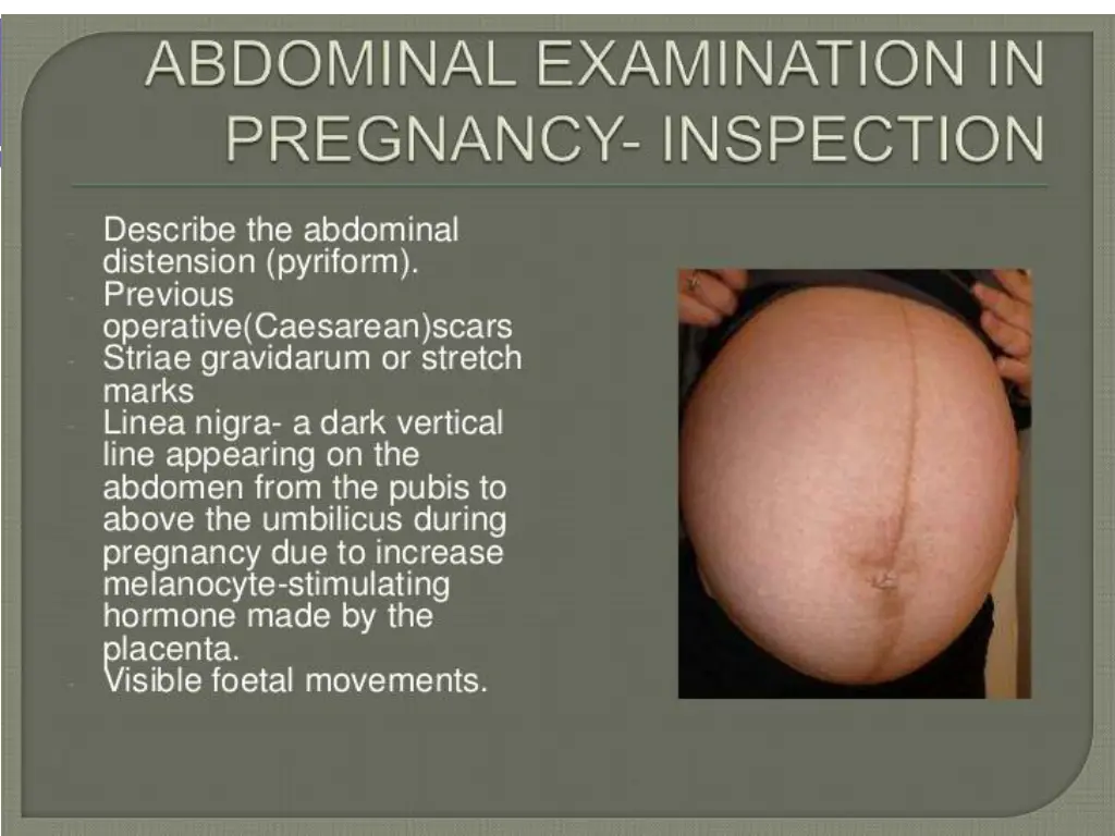 slide8