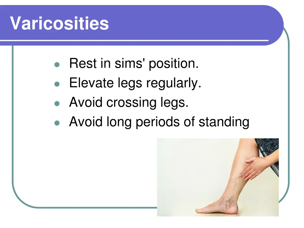 varicosities