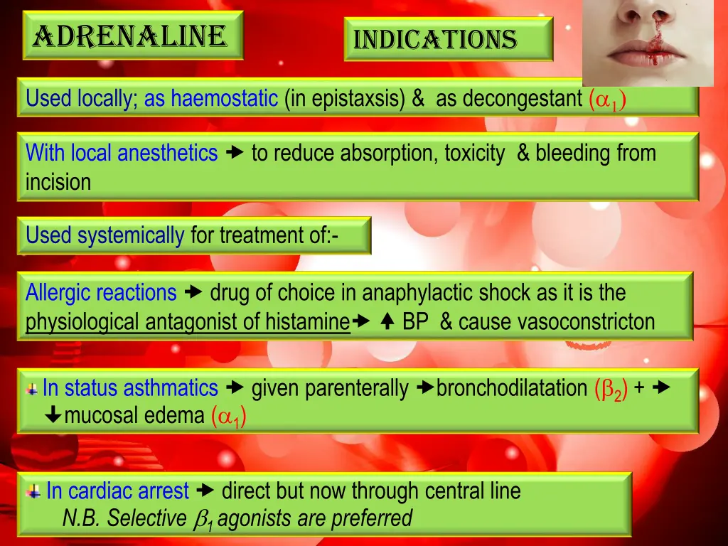 epistaxis