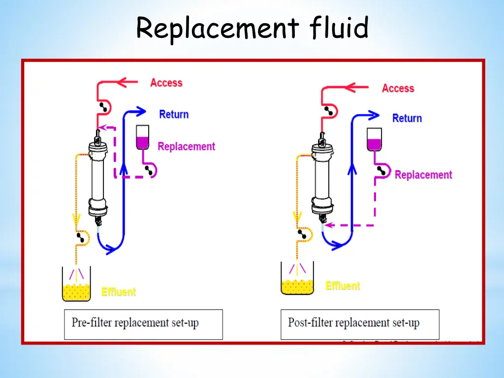 replacement fluid