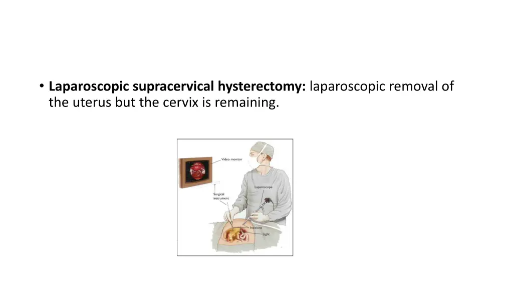 laparoscopic supracervical hysterectomy