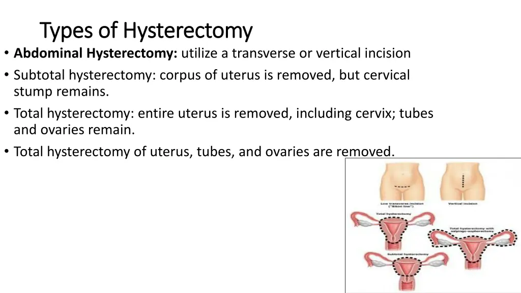 types of hysterectomy types of hysterectomy