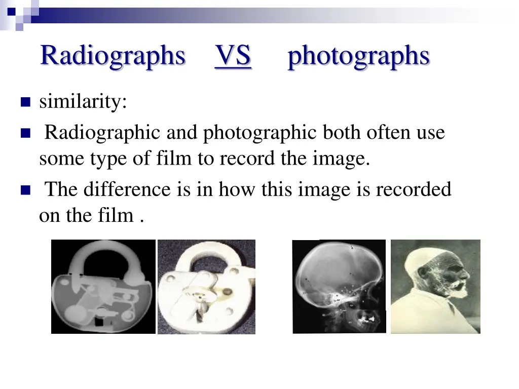 radiographs vs