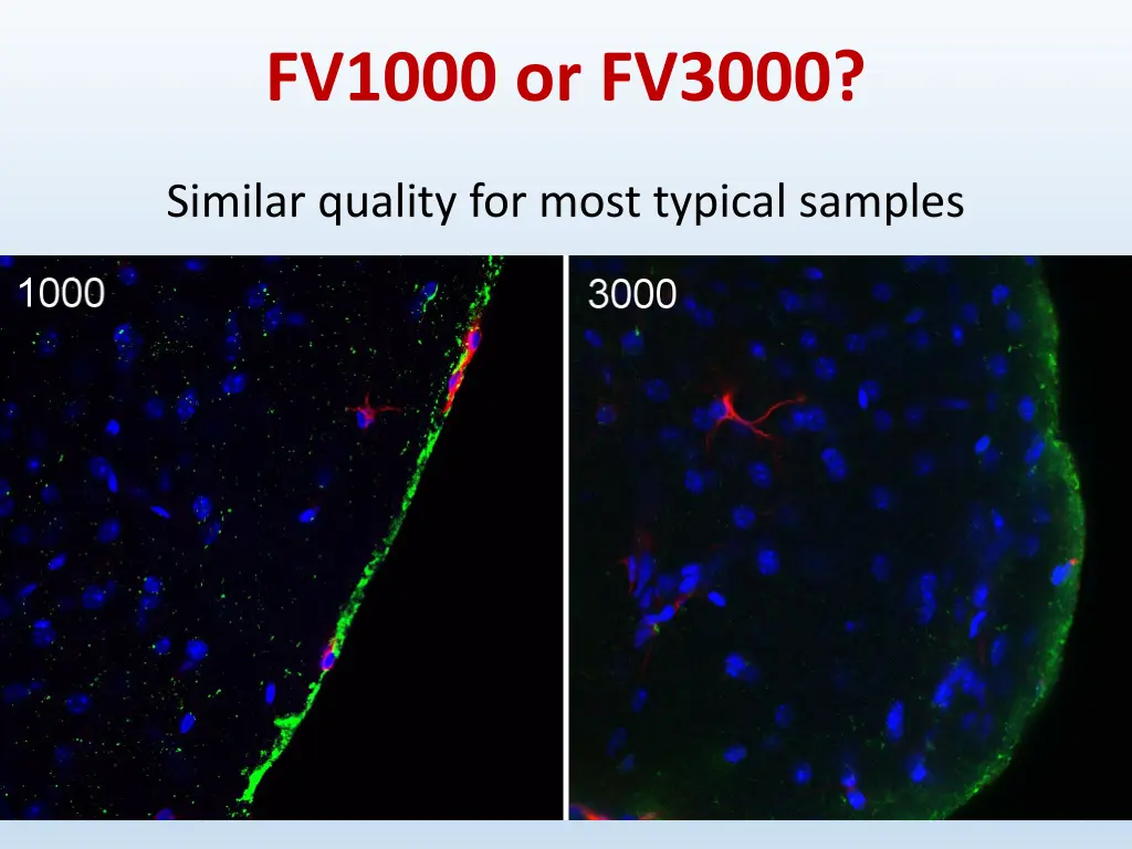 fv1000 or fv3000