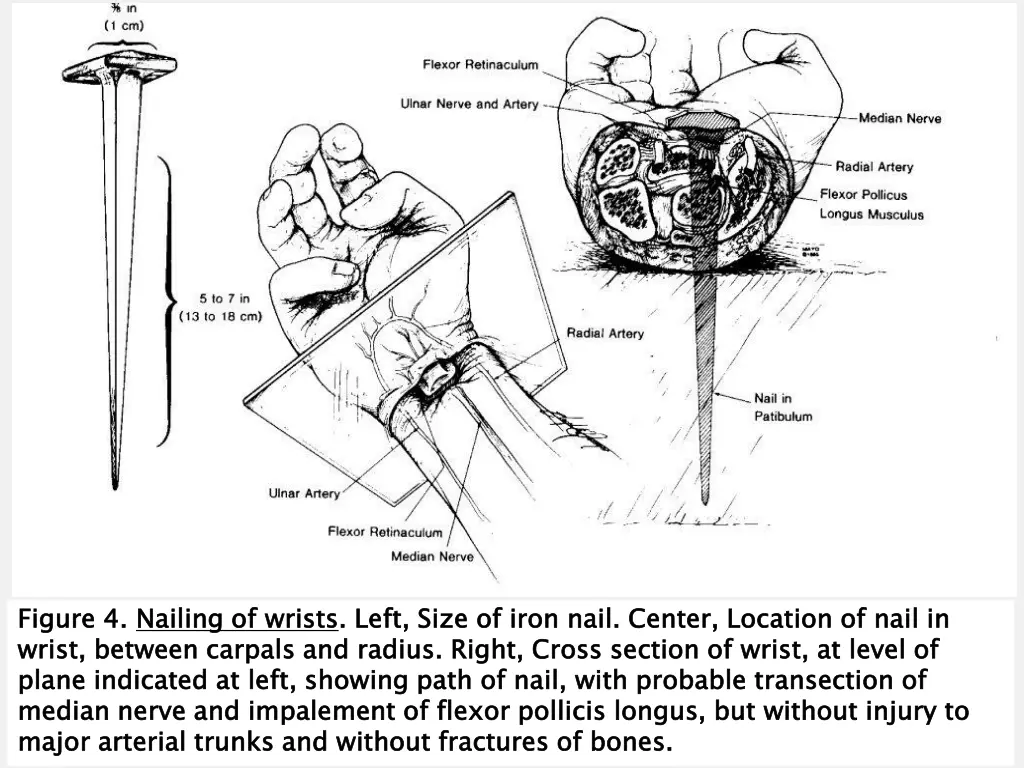 figure 4 wrist between carpals and radius right