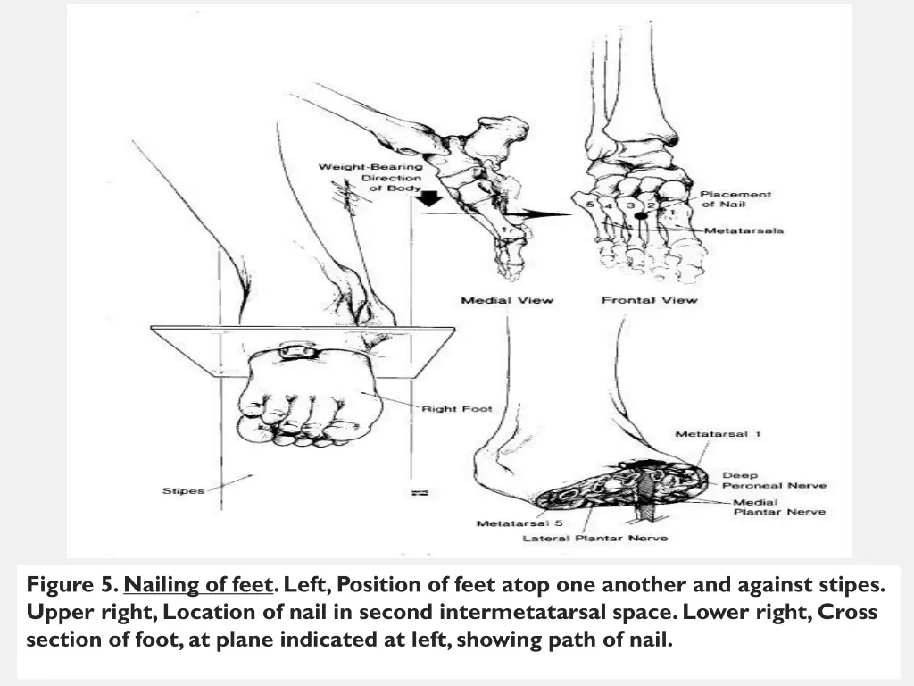 figure 5 nailing of feet left position of feet