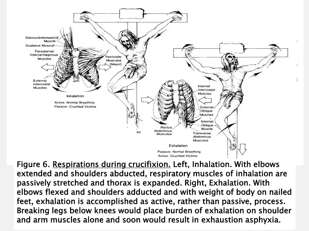 figure 6 extended and shoulders abducted