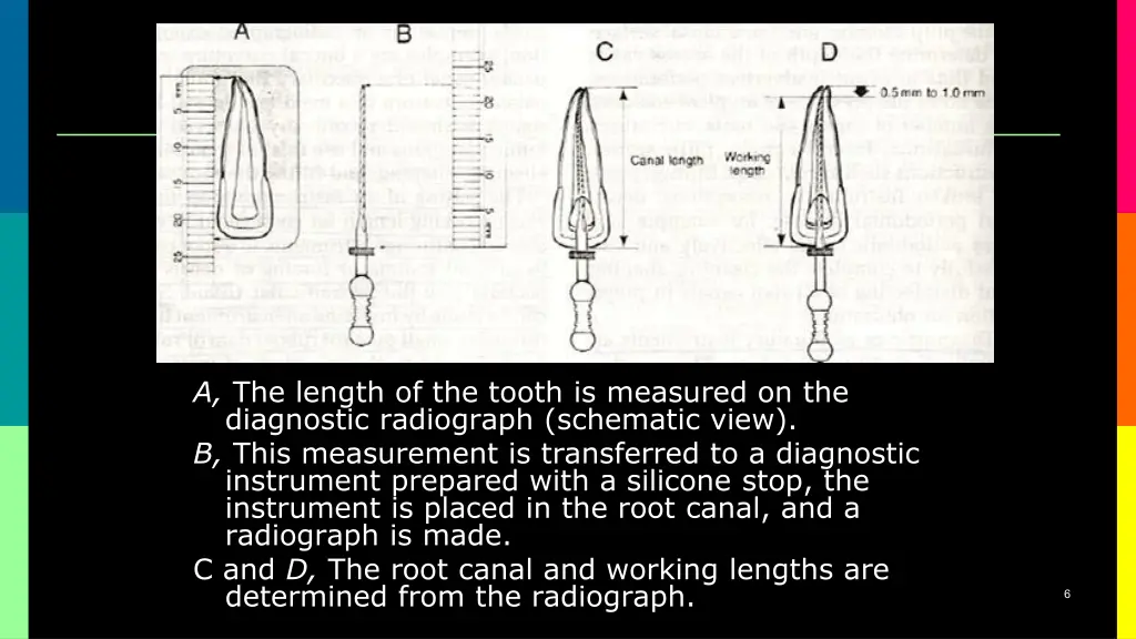 a the length of the tooth is measured