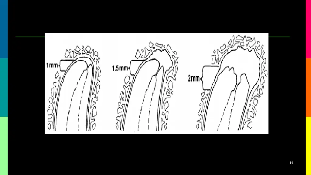 slide14