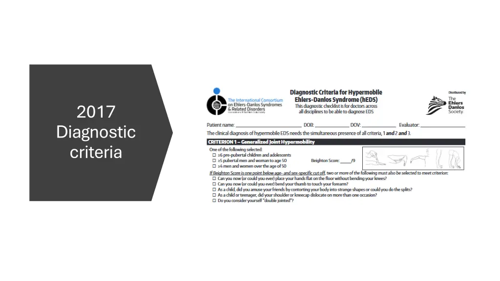 2017 diagnostic criteria
