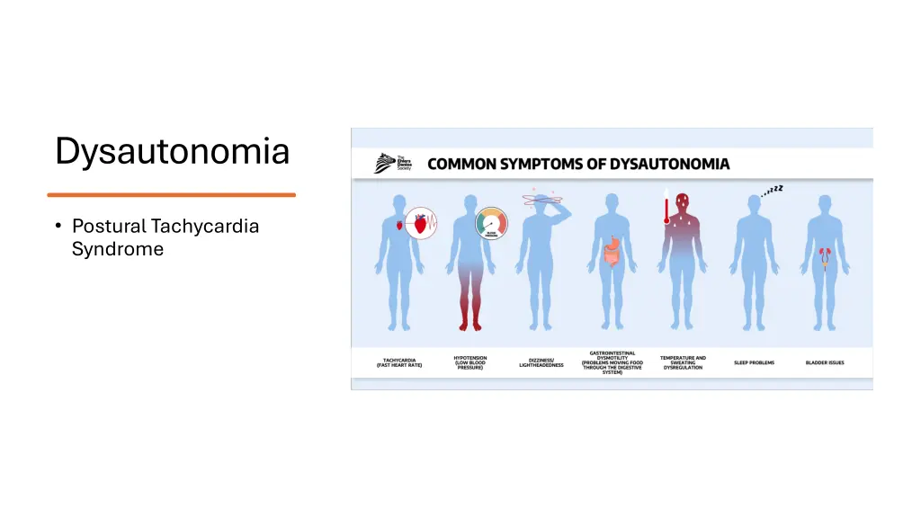 dysautonomia