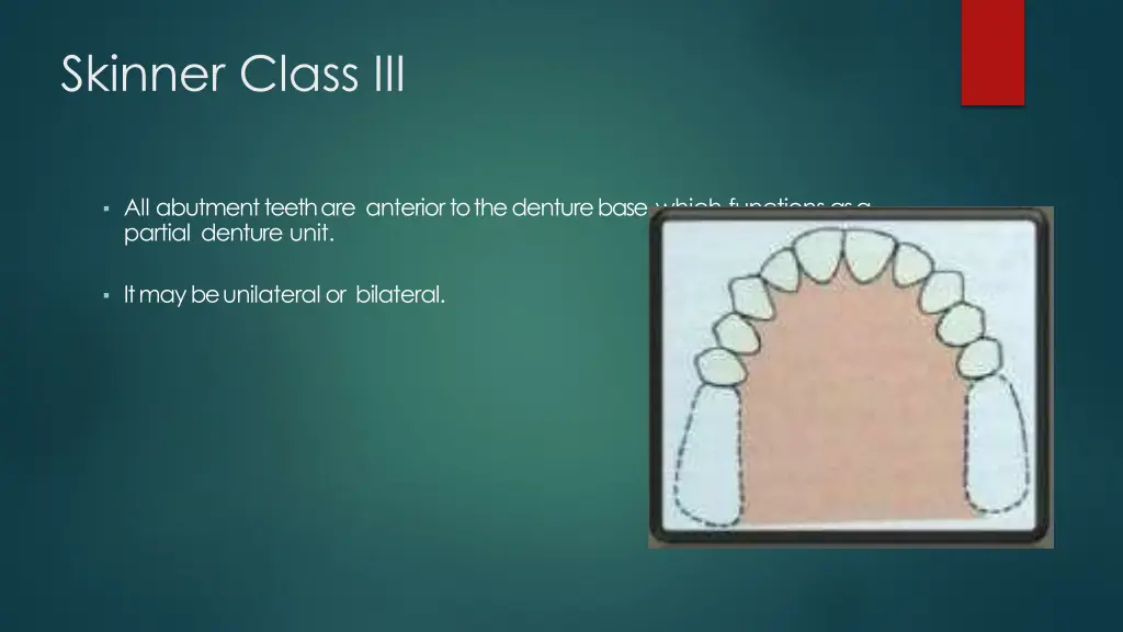 skinner class iii