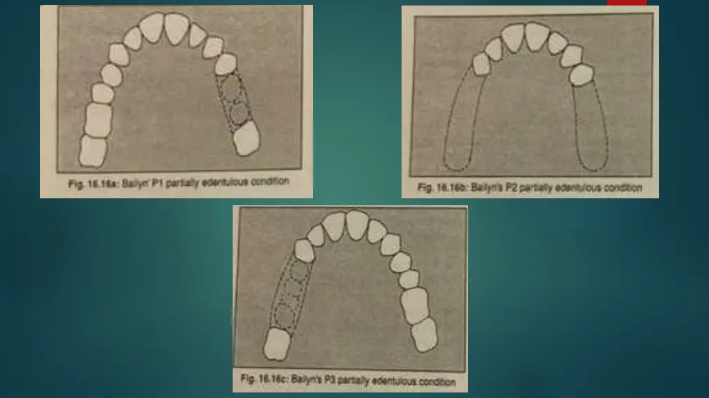slide13