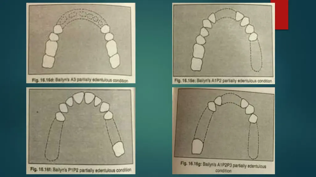 slide14