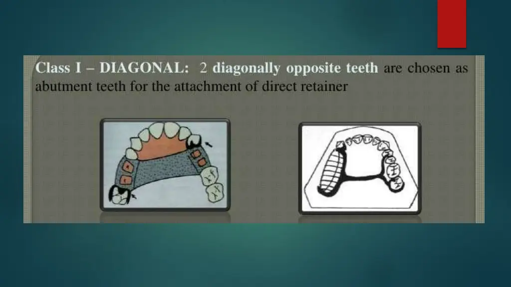 slide16