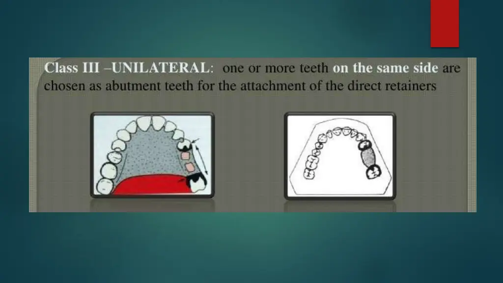 slide18