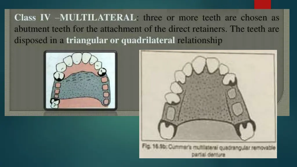 slide19