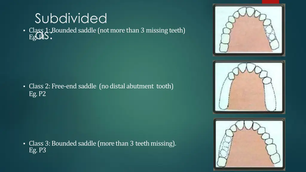 subdivided as eg pi