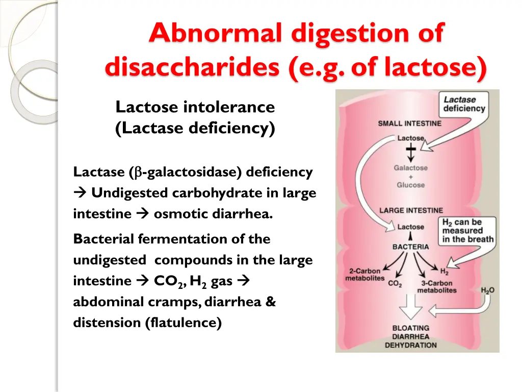 abnormal digestion of disaccharides e g of lactose