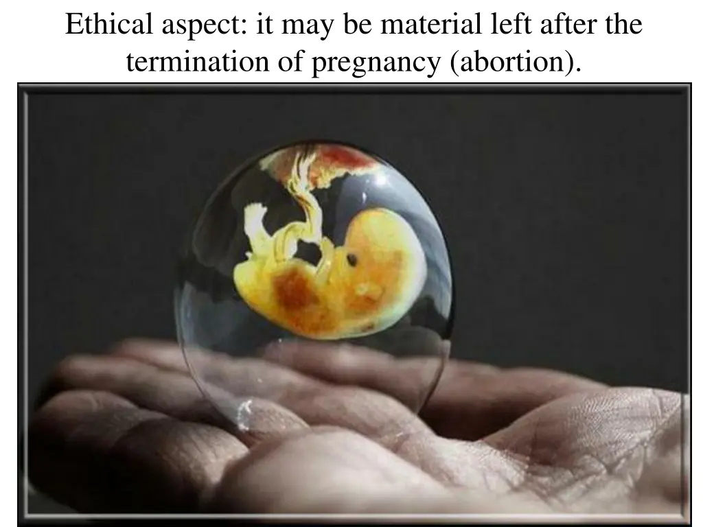 ethical aspect it may be material left after