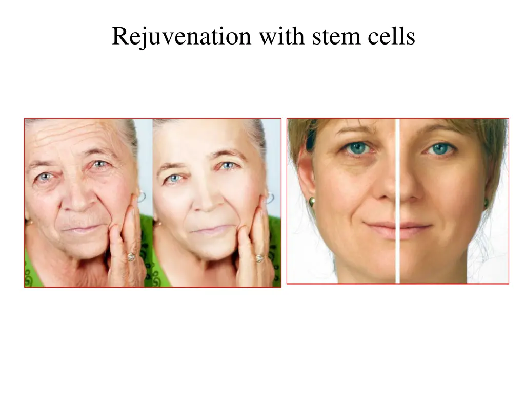 rejuvenation with stem cells