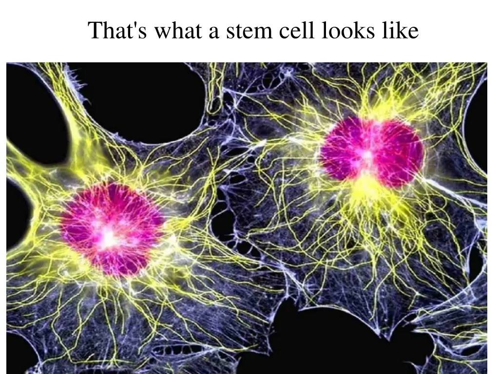 that s what a stem cell looks like