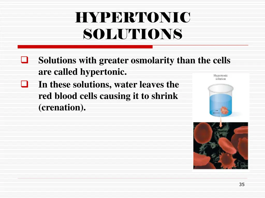 hypertonic solutions