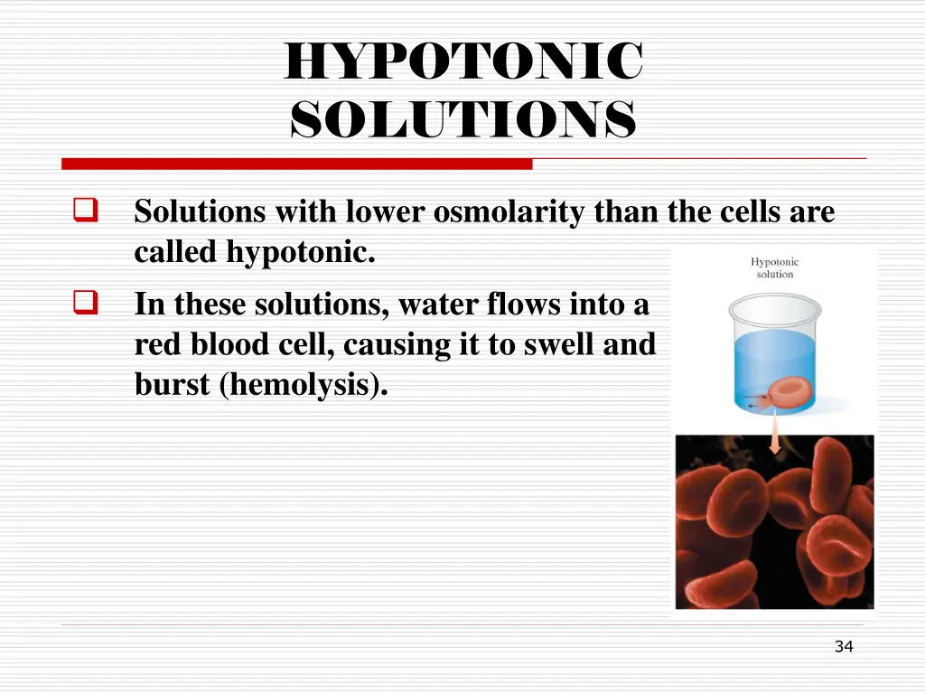 hypotonic solutions
