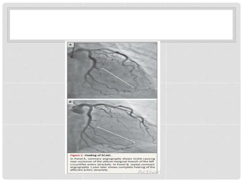 slide36