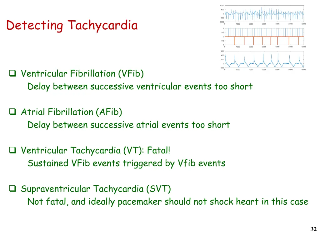 detecting tachycardia
