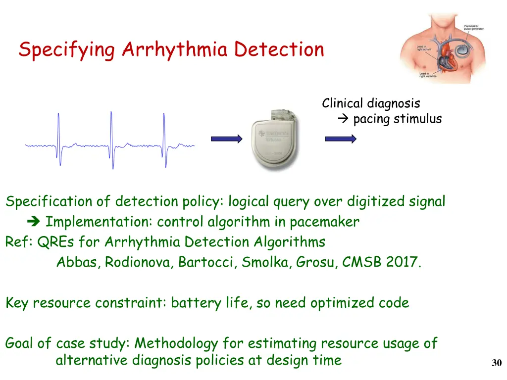specifying arrhythmia detection