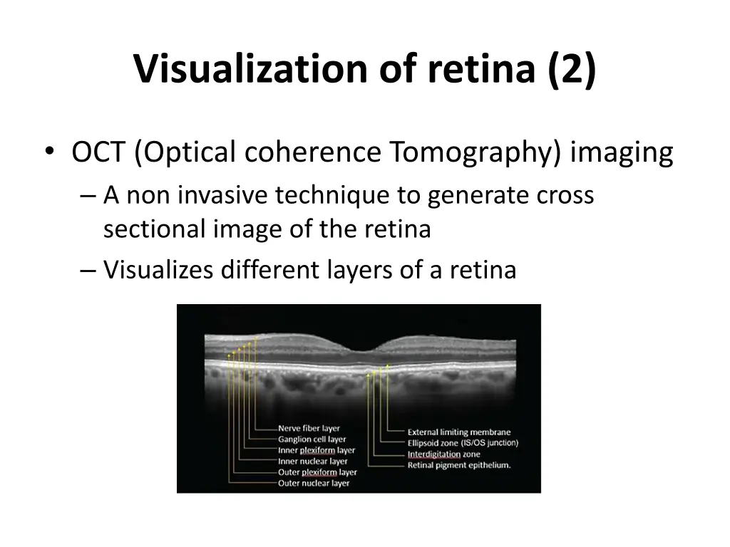visualization of retina 2