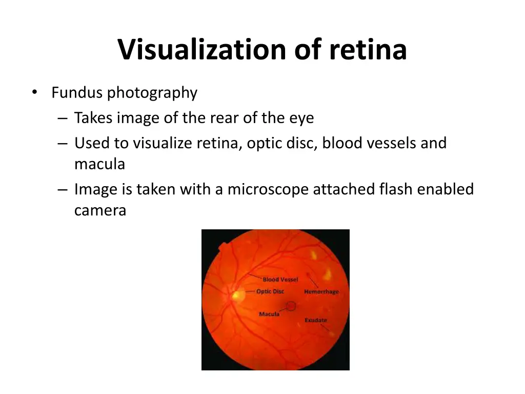 visualization of retina