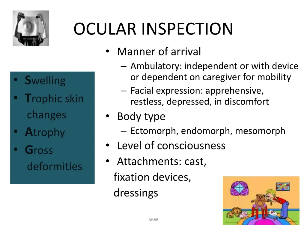 ocular inspection manner of arrival ambulatory